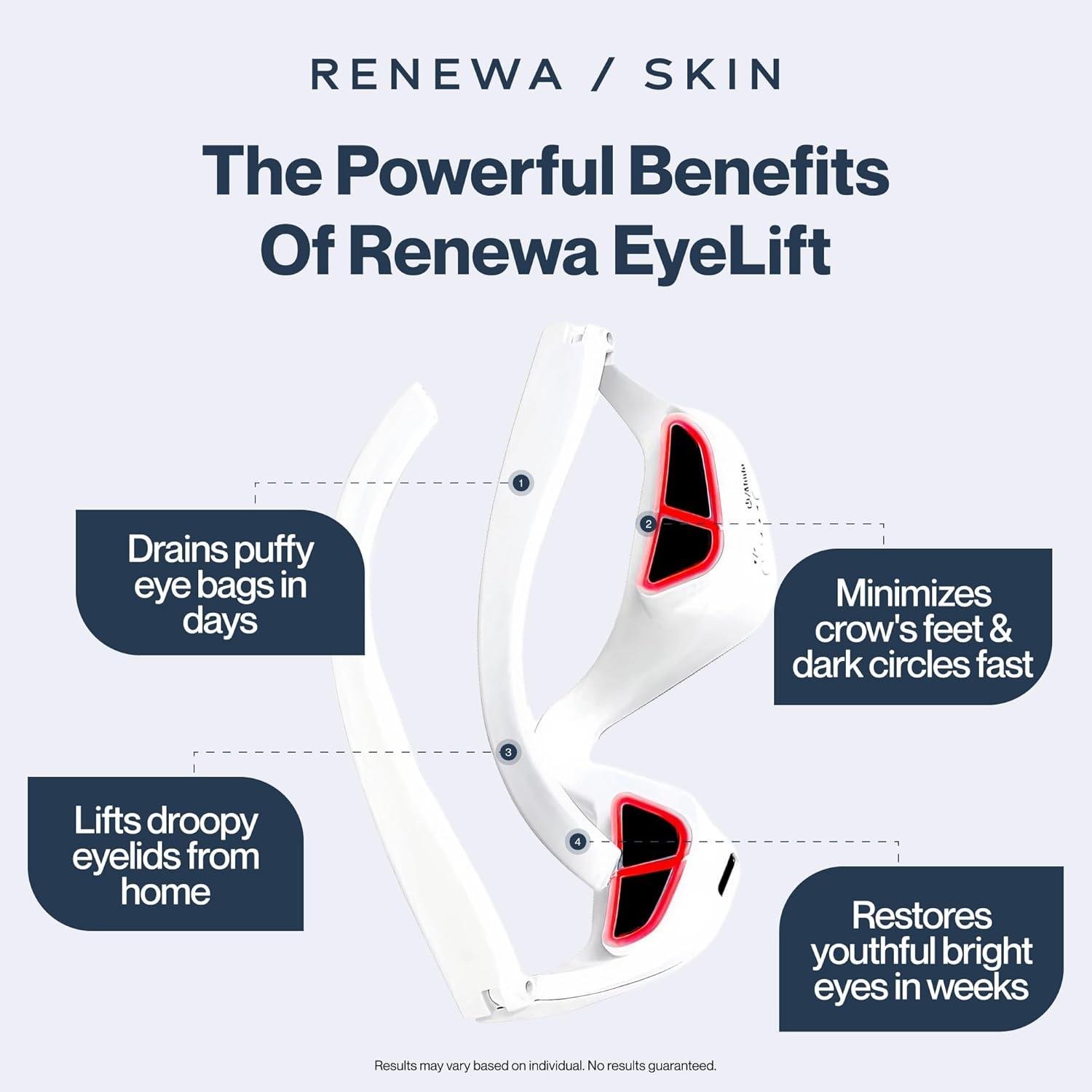 Renewa EyeLift Review: Does It Work for Puffy eyes?