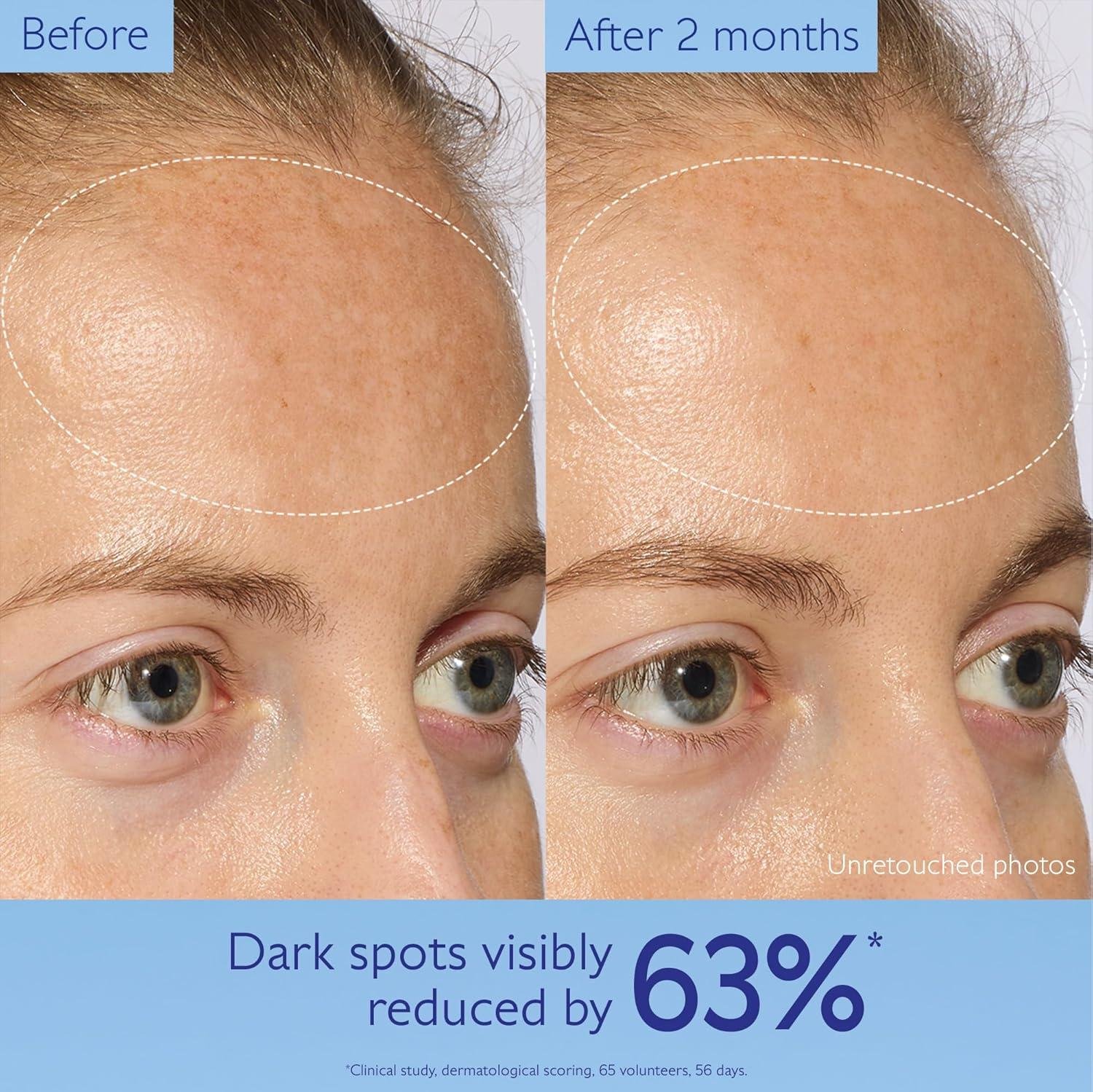 Caudalie Vinoperfect Review: Does It Work for Dark Spots?
