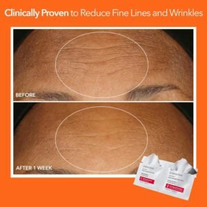 Dr. Dennis Gross Peel Review: Worth It for Aging Skin?