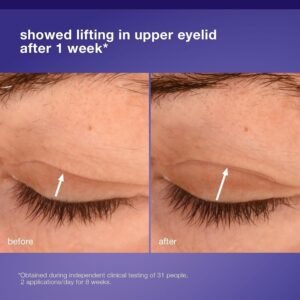 Dermalogica Phyto Nature Eye Cream: Worth It for Lines?
