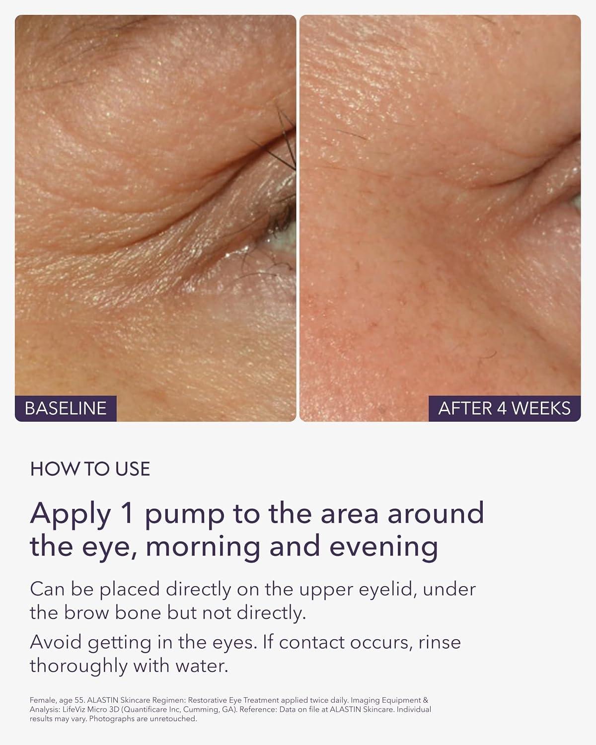 ALASTIN Eye Complex Review: Does It Really Work?