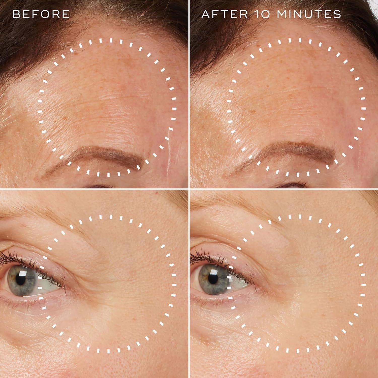 Medik8 Liquid peptides Review: Does It Reduce Wrinkles?