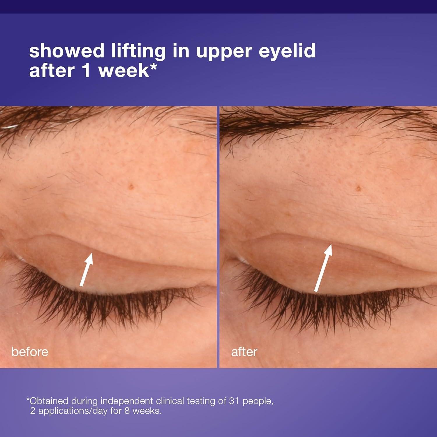 Dermalogica Phyto Nature Eye Cream: Worth It for Lines?