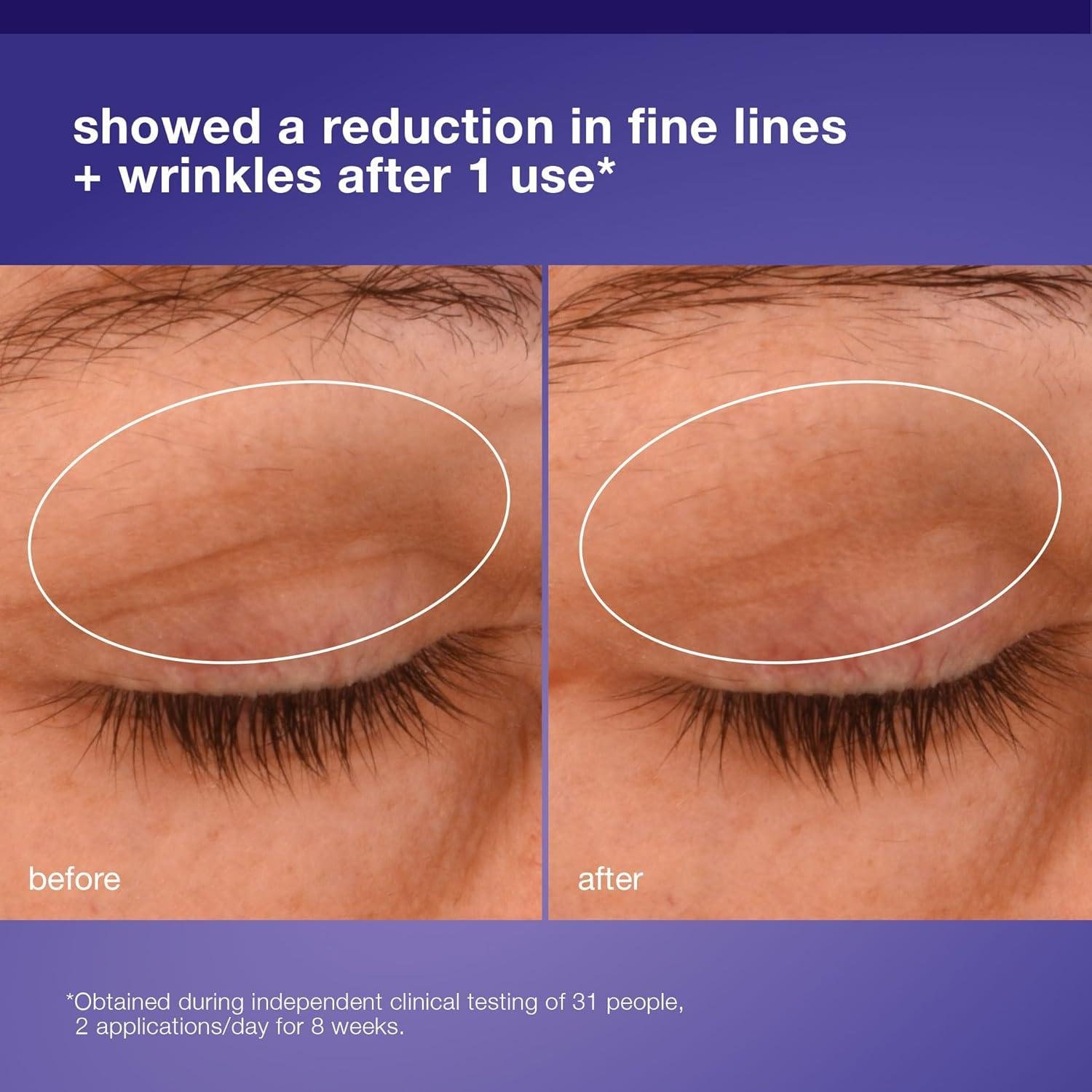 Dermalogica Phyto Nature Eye Cream: Worth It for Lines?