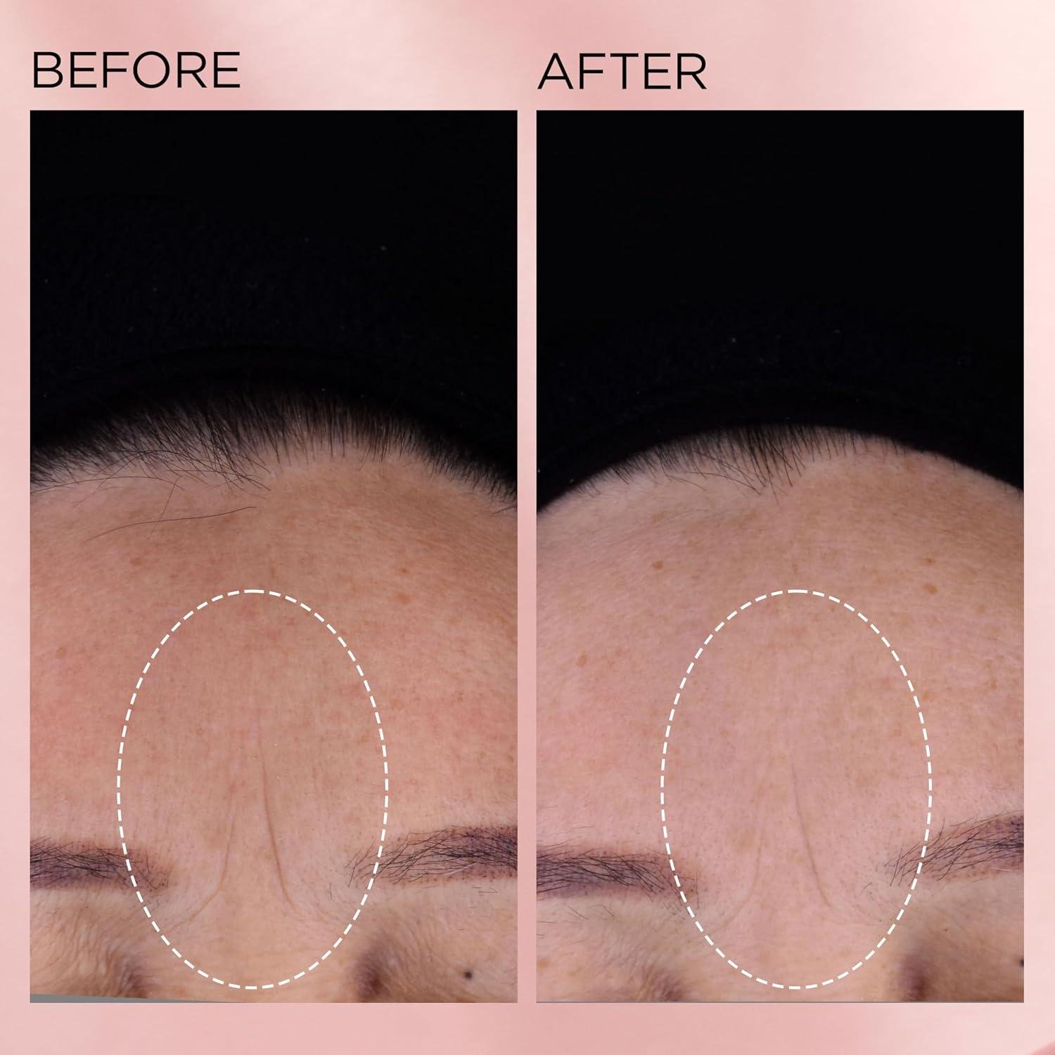 Elizabeth Arden retinol Capsules: Worth It for Aging skin?