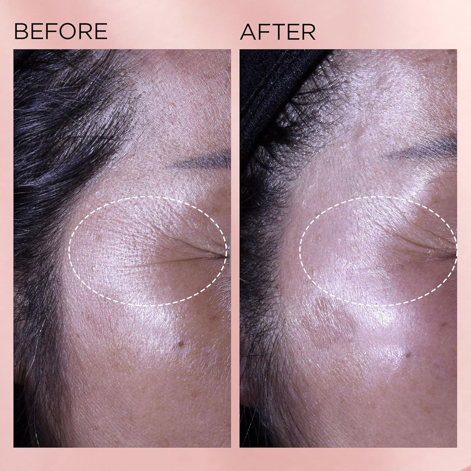 Elizabeth arden Retinol Capsules: Worth It for Aging Skin?