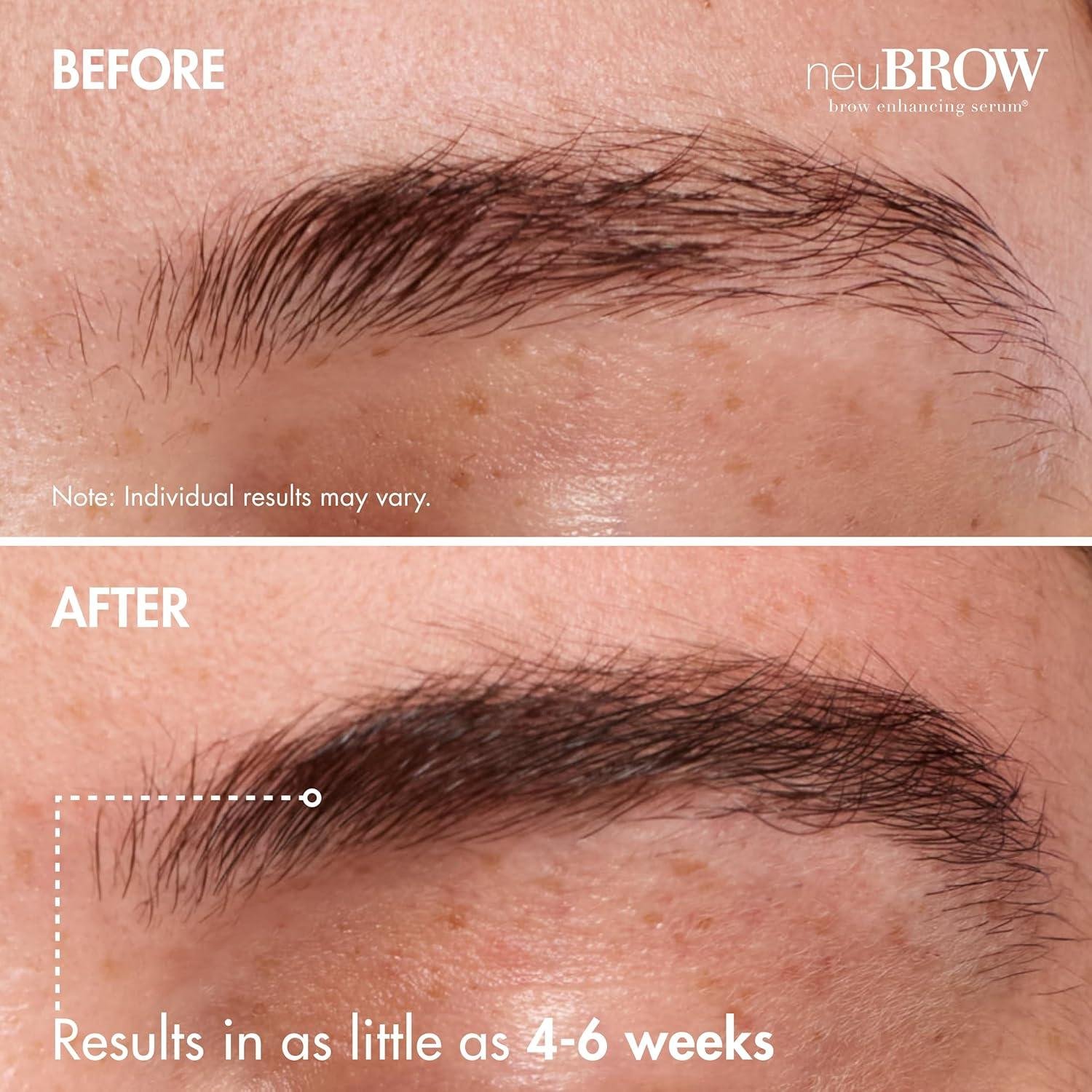 NeuBROW Serum Review: Does It Work for Sparse Brows?