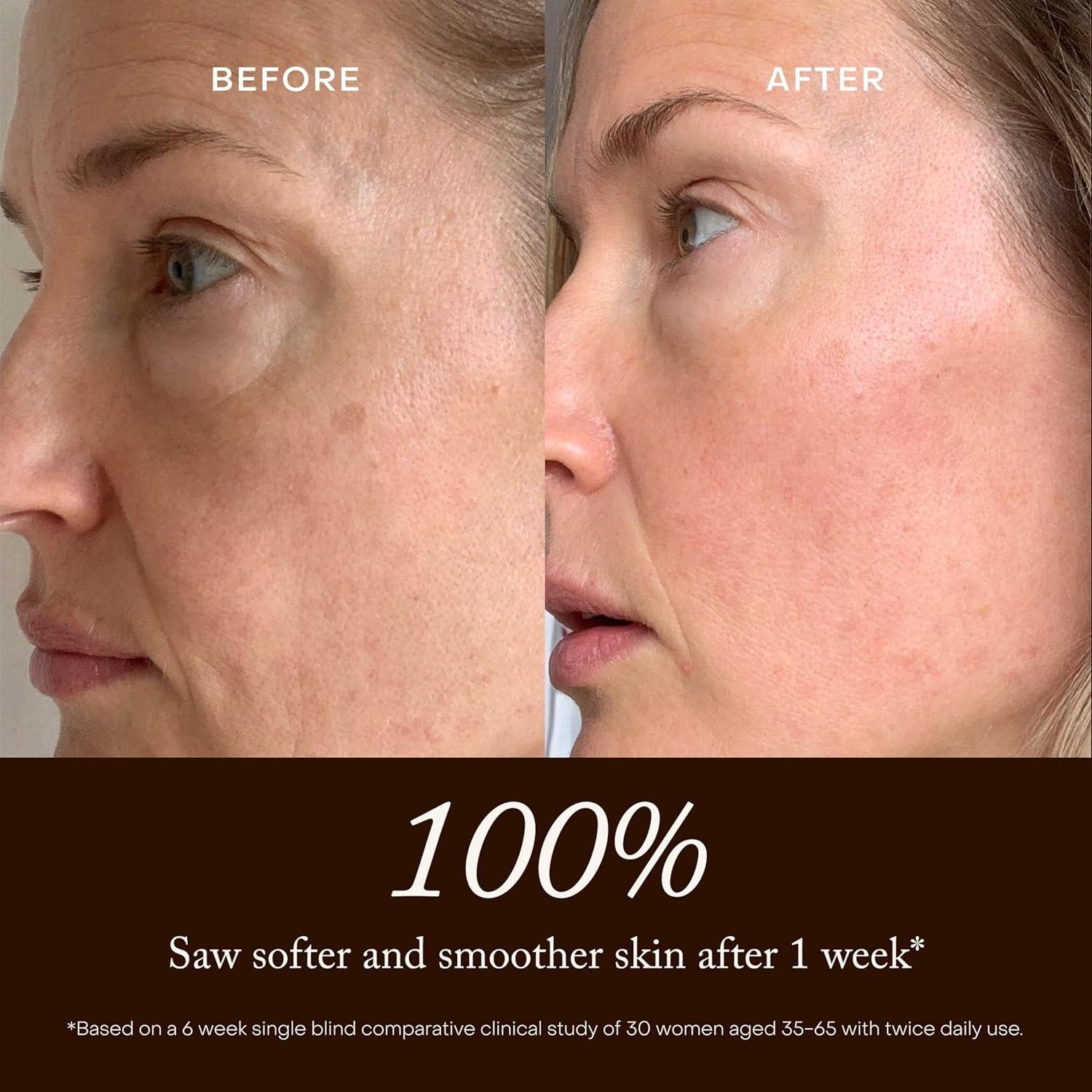 True Botanicals Chebula Serum: does It Really Work?