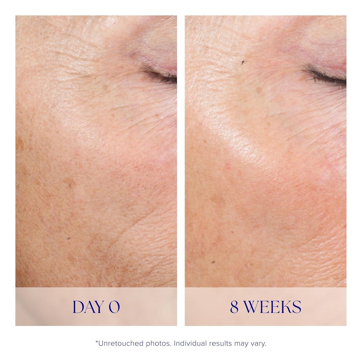 IS CLINICAL Active Peel Review: Worth It for At-Home Use?