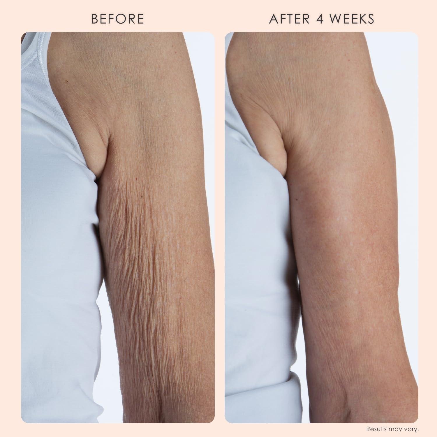 Crepe Erase Body Firm Review: Does It Work for Crepey Skin?