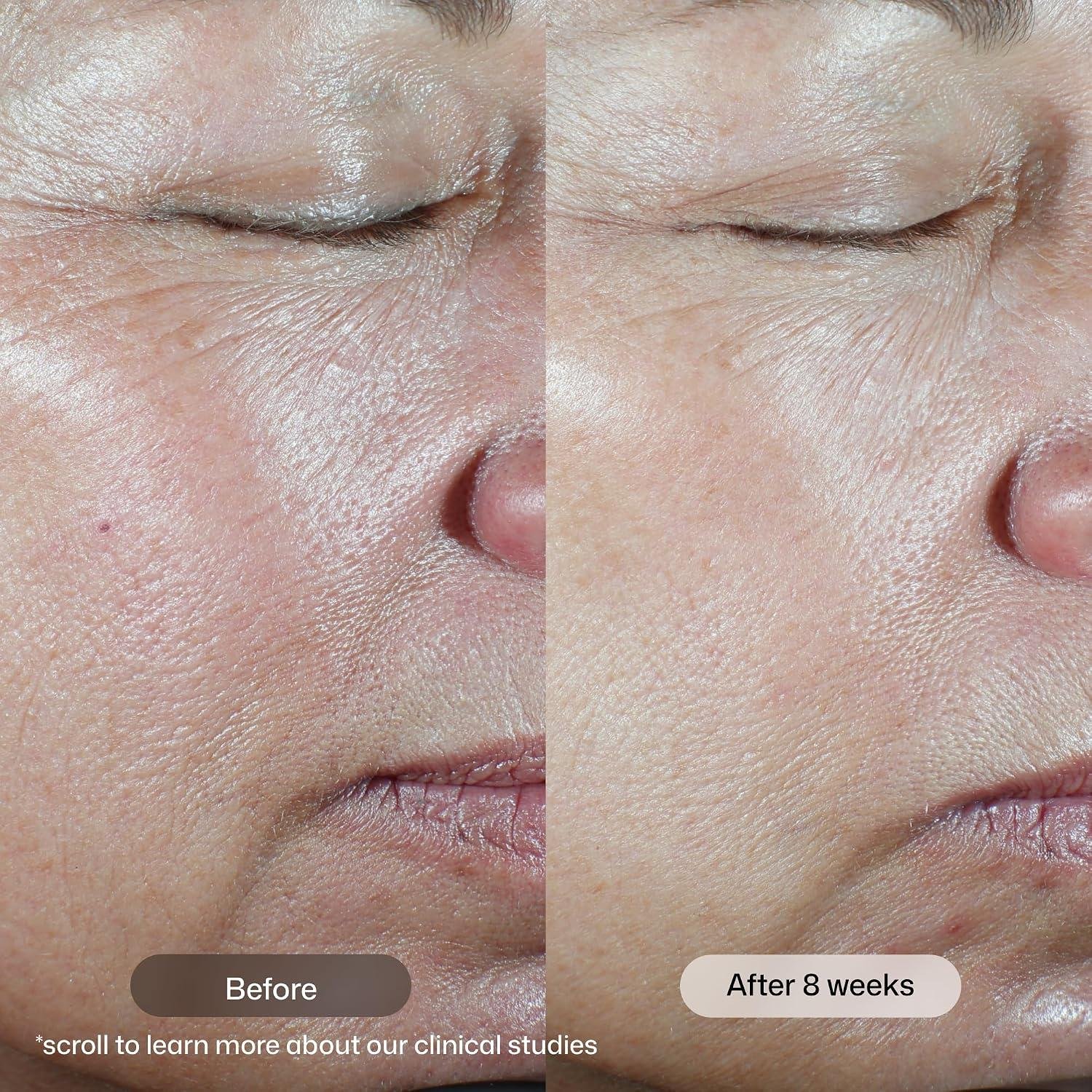 Revision Vitamin C Serum Review: Safe for sensitive Skin?