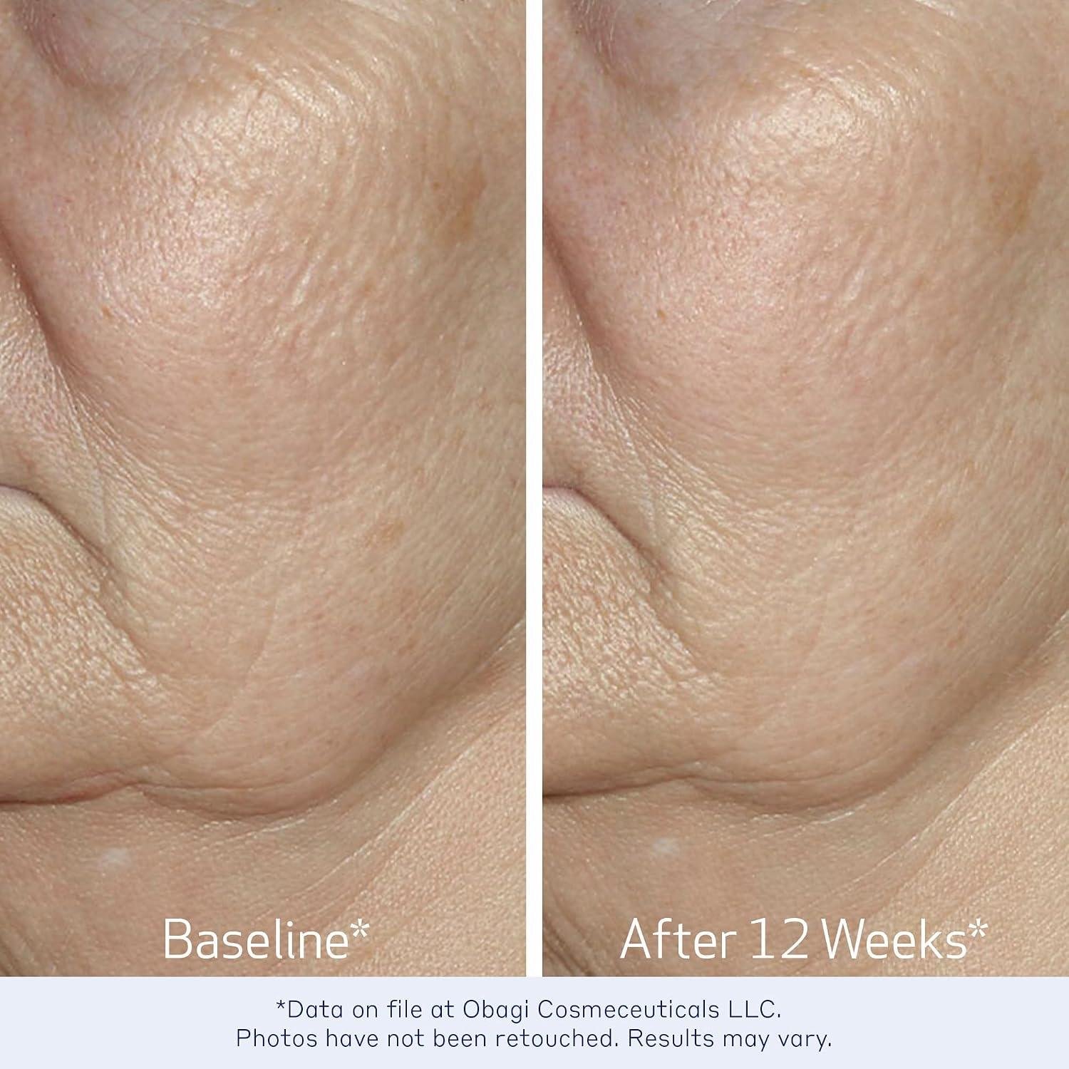 obagi ELASTIderm Serum Review: Does It Firm Skin?